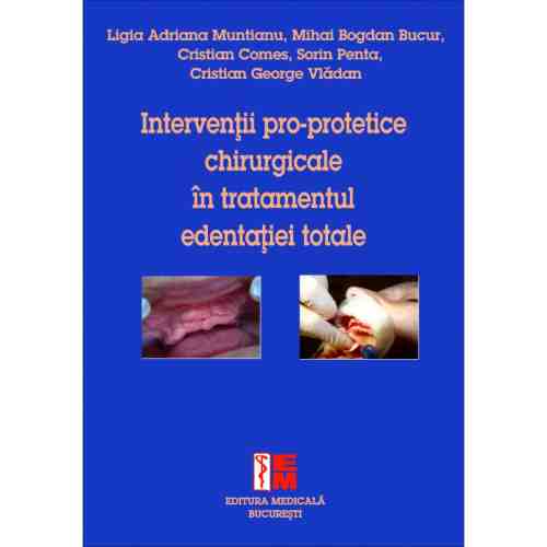 Interventii pro-protetice chirurgicale in tratamentul edentatiei totale | Ligia Adriana Muntianu, Mihai Bogdan Bucur, Cristian Comes, Sorin Penta, Cristian George Vladan
